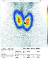 Discover more posts about szintigramm. Schilddrusensprechstunde Radiologisches Institut Dr Von Essen Koblenz Simmern Im Hunsruck