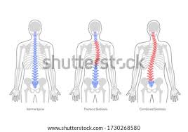 Mar 20, 2015 · the eight bones of the wrist are:. Shutterstock Puzzlepix