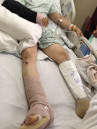 Motorcycle Accident Lawyer Houston Millions Recovered