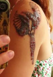 Removery exists to empower you to become who you want to be, by giving you choices over your tattoos. This Is Pretty Rank 24hrs After A Laser Tattoo Removal Session Actually My 8th Session So Painful Also A Pretty Bad Photo Doesn T Do The Blisters Justice Imgur