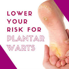Don't pick at or scratch warts. Risk Factors For Plantar Warts Family Foot Ankle