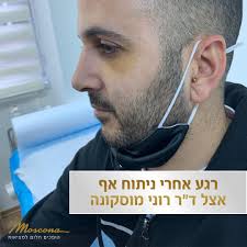 ניתוח אף הינו אחד מהניתוחים הפופולאריים ביותר בישראל. Sft2 Alaivs3qm