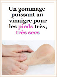 Un Gommage Puissant Au Vinaigre Pour Les Pieds Tres Tres Secs Gommage Soin Des Pieds Sante Et Beaute