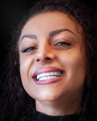 With Smile Design we are creating a perfect smile lines and confidences for  our patients. ✨ ✨ ✨ 🔴 Process : smile design ⏰treatment period: 4 Days  🩺side effect: Non 😱pain level: