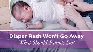 Image result for newborn diaper rash