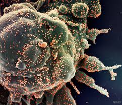 Maybe you would like to learn more about one of these? Apod 2020 June 2 Novel Coronavirus Attacks Humanity