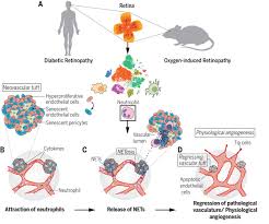 Maybe you would like to learn more about one of these? Neutrophil Extracellular Traps Target Senescent Vasculature For Tissue Remodeling In Retinopathy Science