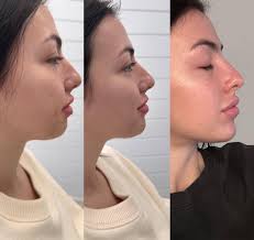 Colasanti's is the best! Quality, friendly service and good prices!