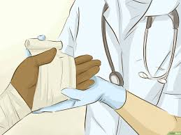 كيفية علاج الحروق باستخدام الصبار 9 خطوات صور توضيحية Wikihow