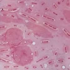 Image result for Rhizobium radiobacter, syn. Agrobacterium tumefaciens