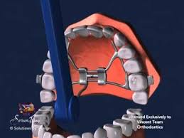 Youtube Orthodontics Dentistry Dental