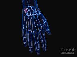 Image result for Pisiform Bone