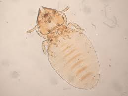 Image result for what do Mallophaga look like in dog fur