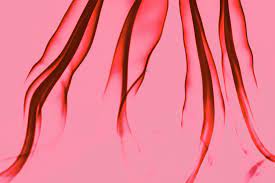 Alle Tipps Was Tun Bei Starker Menstruationsblutung