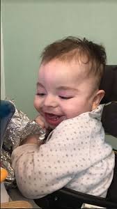 It consists of the development of the isochromosome 12p, which has two abnormally small legs. A Little Boy Has Such A Rare Condition That Only 300 People Have Ever Been Diagnosed With It Wales Online