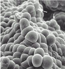 Maybe you would like to learn more about one of these? Lon Capa Botanik Online Protoplasten Und Gewebekulturen Meristem Und Kalluskulturen