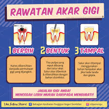 Perawatan tersebut dilakukan apabila pulpa membengkak atau terinfeksi sehingga gigi mengalami pembusukan. Pejabat Kesihatan Pergigian Daerah Rembau Posts Facebook