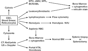 Image result for Splenomegaly