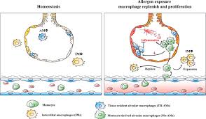 The clinic also provides desensitization therapy. Macrophage Polarization And Allergic Asthma Translational Research