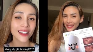 Võ Hoàng Yến trữ đông trứng ở tuổi 35 để làm thụ tinh ống nghiệm sinh con  đầu lòng