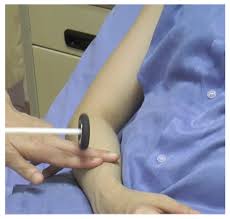 Image result for Supinator Reflex