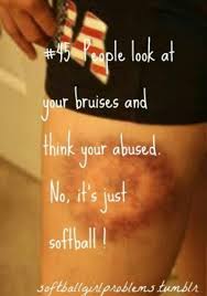 Softball bruises. | Softball life&lt;3 | Pinterest | Softball ... via Relatably.com