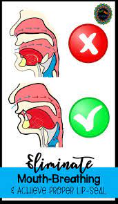 Eliminating Mouth Breathing And Establishing Proper Lip Seal Speech Therapy Speech Therapy Speech Therapy Materials Articulation Therapy