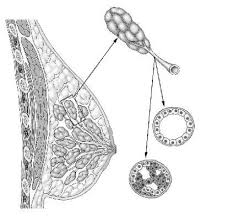 Therefore, the most common areas of the skin affected by bowen. How To Individualize Cancer Risk Reduction After A Diagnosis Of Dcis Mdedge Obgyn