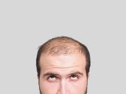Braids are always in fashion, no matter the part the hair in small sections with the help of a comb. Short White Men More Likely To Go Bald Study Arab News