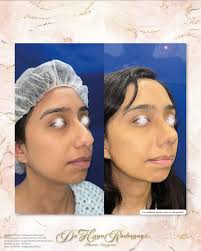 Dr. Hugo Rodriguez Cirugía plástica, estética y Reconstructiva added a new  photo — in Ciudad Juárez,...