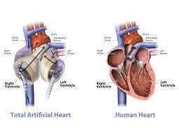 Your heart's electrical system controls your heartbeat, beginning in a group of cells at the top of the heart (sinus node) and spreading to the bottom, causing it to contract and pump blood. Mechanical Hearts Could Replace Our Flesh And Blood Ones