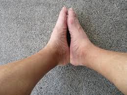 Image result for Pigment stains on the shin