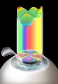 160 Lasik Promo Ideas Lasik Lasik Eye Surgery Lasik Surgery