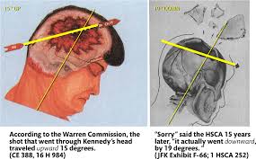 Autopsy forensic browser is a graphical interface to the sleuth kit and other analysis tools. Download John F Kennedy Autopsy Png Image With No Background Pngkey Com