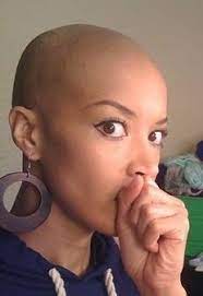 Follow Black Women Natural Hairstyles Natural Hair Styles For Black Women Bald Hair Bald Women