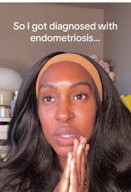 Best Mineral SPF Recommendation for Black Skin with Tretinoin