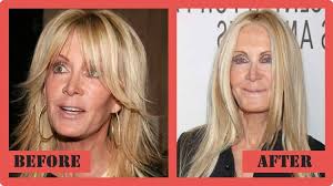 It indicates the ability to send an email. 31 Plastic Surgery Gone Wrong Pictures That Will Make You Feel Uncomfortable But You Can T Look Away Right