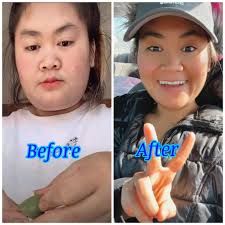 Have you heard of visceral fat? Do you know how how much visceral fat you  have in your body? Do you know how to reduce it? It's mainly from diet.  Unfortunately exercise