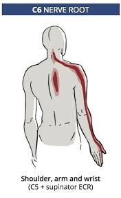 Pin On Neck And Shoulder Pain