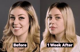 Ebay.com has been visited by 1m+ users in the past month What Do Lip Injections Cost And 10 Other Lip Filler Questions Answered
