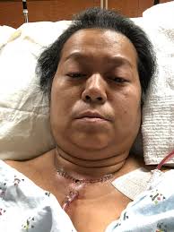 Grateful for strength after breast cancer operation