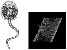 The life cycle of flukes is at first, liver flukes may cause no symptoms, or depending on the type and severity of the infection, they may cause fever, chills, abdominal pain, liver. Fasciola Hepatica Wikipedia