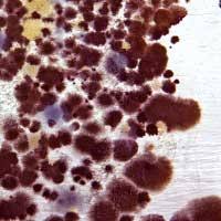 It is important to get on top of excess humidity problems quickly! House Mold Household Mold In Basement Is A Significant Problem