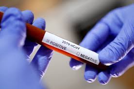 Sometimes they change host and infect humans. Coronavirus And India Faq Of What We Know So Far The Wire Science