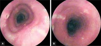 ■ мрт головного мозга в режиме т1. Jaypeedigital Ebook Reader