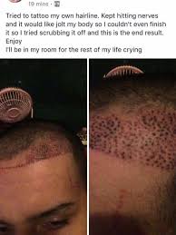 Hairline tattoo transformation at skalp®. Tattooed Hairline