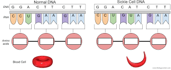 Alternatively, of course, you could well get a code for a different amino acid or even a stop codon. The Genetics Of Sickle Cell Anemia