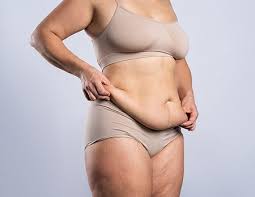 Body Contouring After Weight Loss Naples Fort Myers Bonita Springs Estero Marco Island