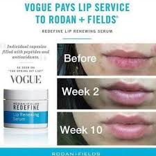 Use benzoyl peroxide to unclog the skin pores and kill bacteria responsible for the pimples and other cystic skin lesion How To Get Rid Of Lip Wrinkles Quora