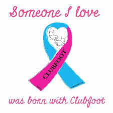 World clubfoot day was introduced in 2013 by ponseti international association, and is celebrated on june 3 every year, commemorating ponseti's birthday. Clubfoot Bahamas Posts Facebook